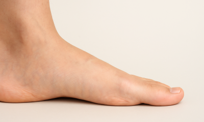 Náhled článku: Plochá noha trápí přes 32 tisíc školáků