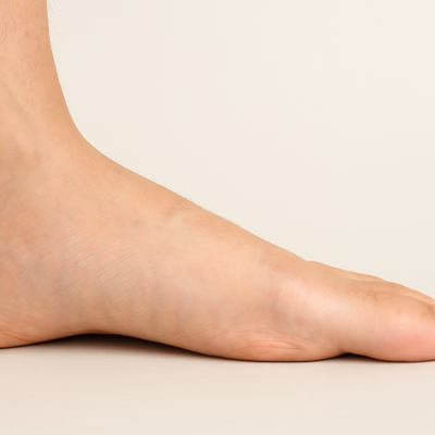 Náhled článku mobil: Plochá noha trápí přes 32 tisíc školáků